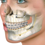 Maxillofacial-Surgery