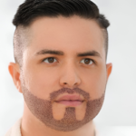 beard hair transplant in islamabad