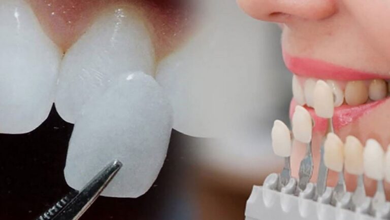 dental smile