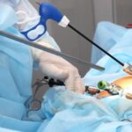 laproscopic surgery in islamabad