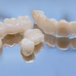 dental crowns harrison county ky