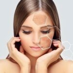 melasma treatment in islamabad