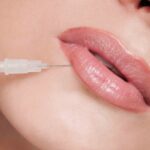 Lip Filler in Islamabad