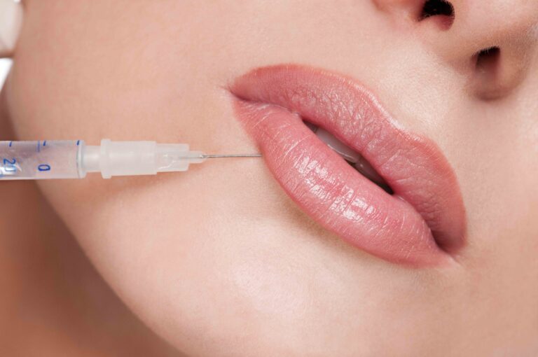 Lip Filler in Islamabad