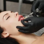 Revitalize Your Look with Expert Dermal Fillers in Dubai