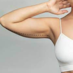arm lift in jeddah