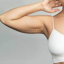 arm lift in jeddah
