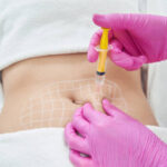 Fat Melting Injection in Riyadh