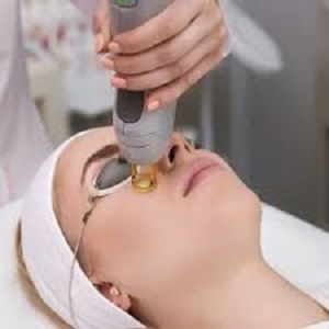 إزالة الشعر بالليزر في دبي