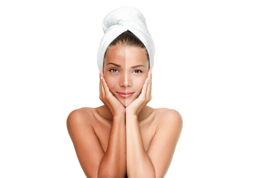 Skin Whitening in Riyadh