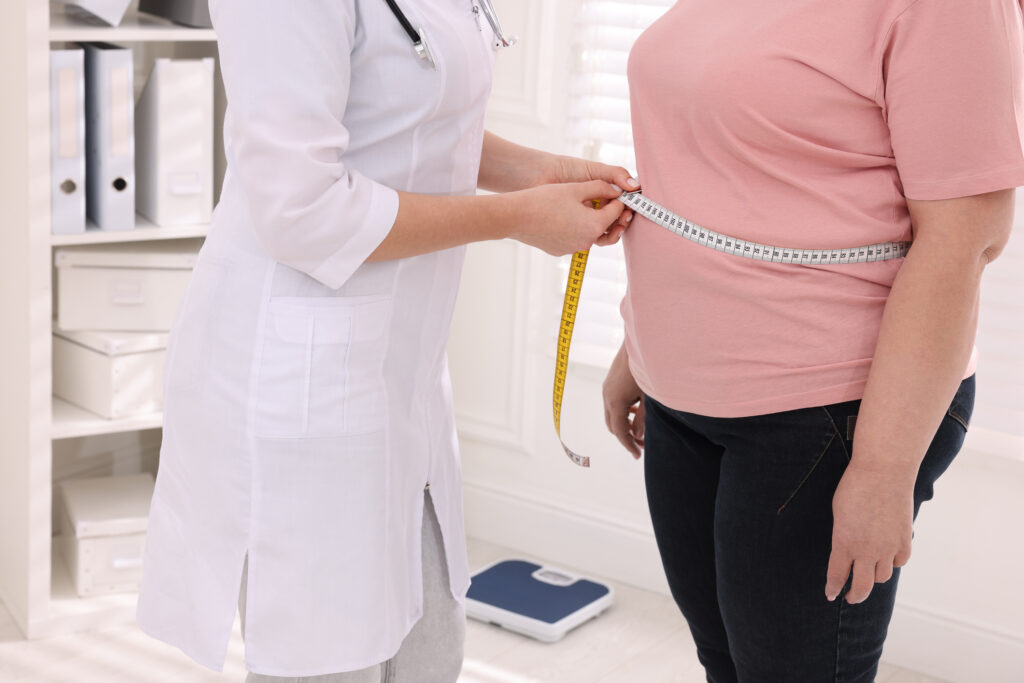 bariatric surgery