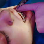 braces san antonio