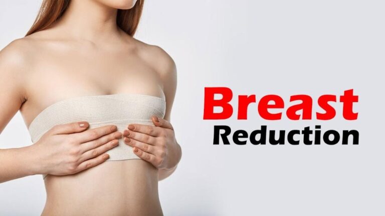 breast reduction