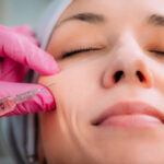 Dermal Fillers Riyadh