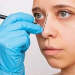 Rhinoplasty in Riyadh