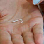 Hormone Pellets Therapy