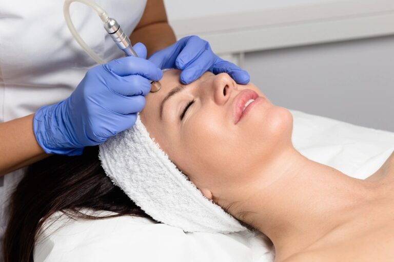 microdermabrasion in islamabad