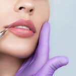 Lip Augmentation in Riyadh