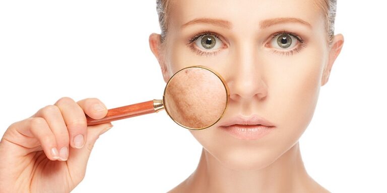 Pigmentation in Riyadh
