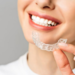 clear aligners