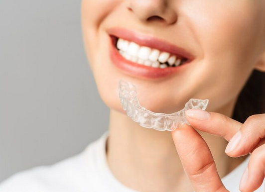 clear aligners