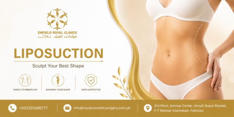 liposuction