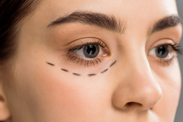 cropped view of young woman with marks on face isolated on grey