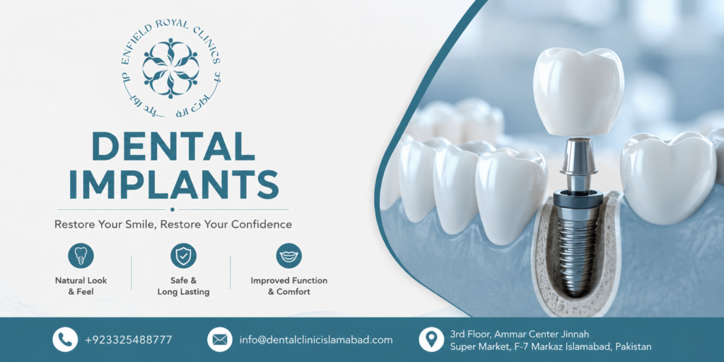 Best Dental Implants in Islamabad