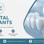 Best Dental Implants in Islamabad