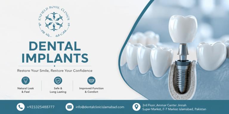 Best Dental Implants in Islamabad