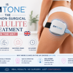 Is EMTONE the Best Non-Surgical Cellulite Treatment in the UK?