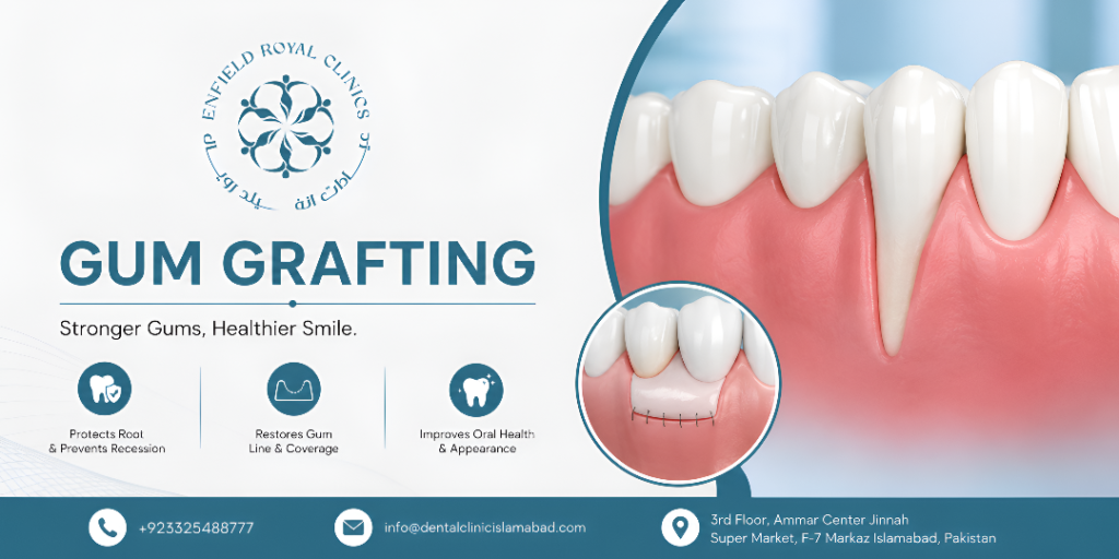 Gum Grafting in Islamabad