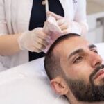 Hair Loss Treatment in Dubai