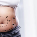 Mommy Makeover Dubai