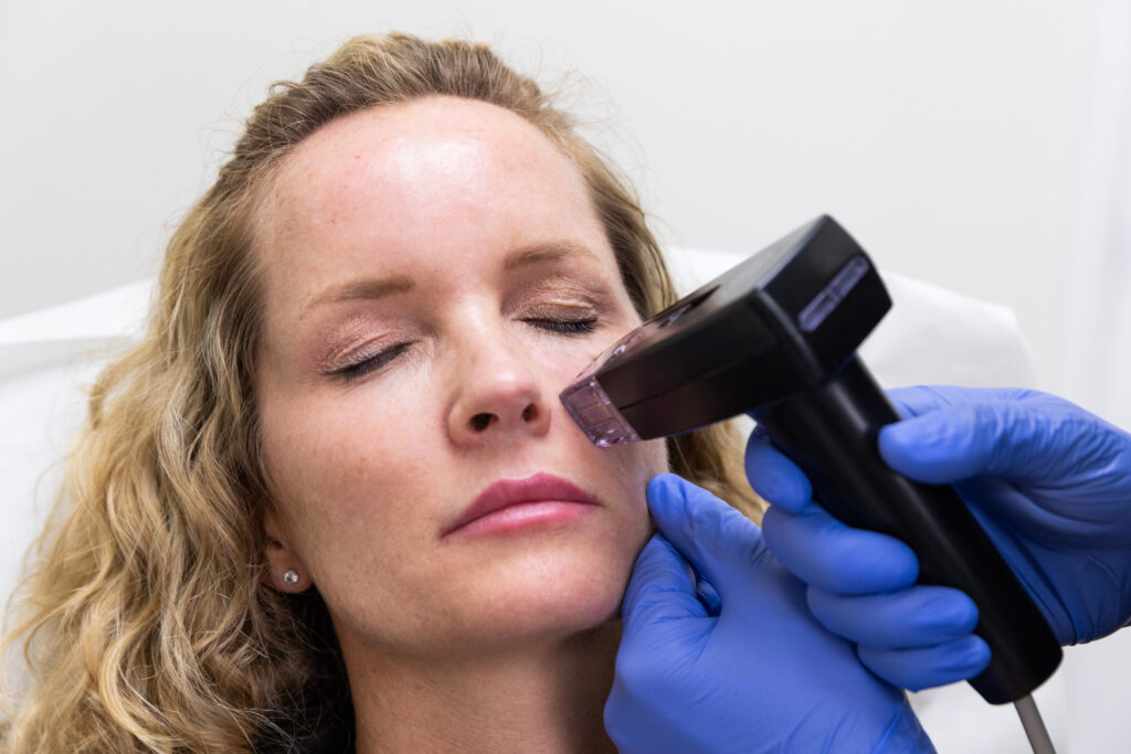Morpheus8 Treatment Dubai