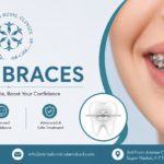 Teeth Braces in Islamabad