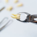 dental extraction athens al
