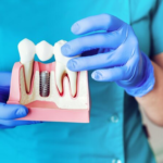 implant dentist Pikeville KY