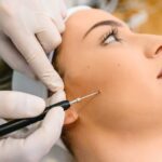 mole-removal