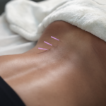Manual Therapy in Dubai UAE