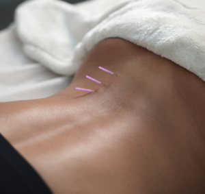 Manual Therapy in Dubai UAE