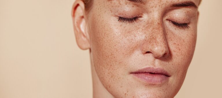 Understanding Recovery After Pigmentation Treatment in Dubai