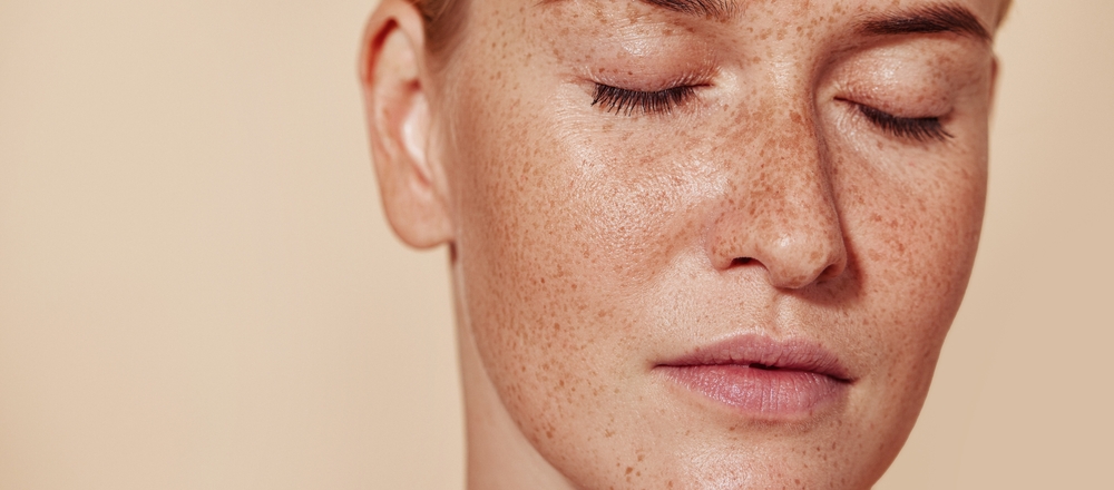 Understanding Recovery After Pigmentation Treatment in Dubai