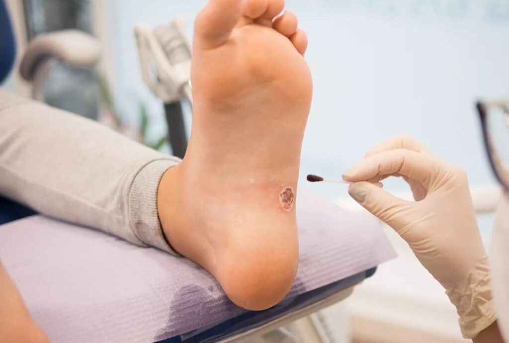 Chronic wound management at home in Michigan