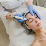 hydrodermabrasion facial edmonton