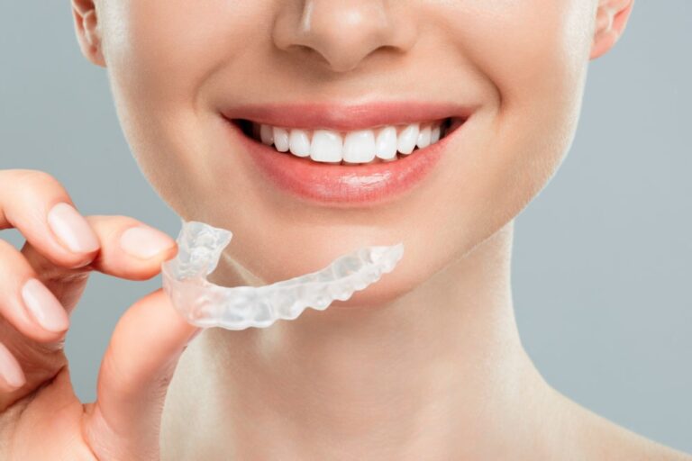 invisible-aligners